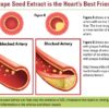 OPC Capsules (French Grape Seed Extract)